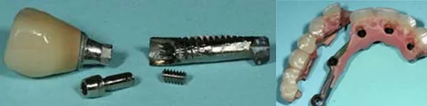 Dental Implant tools