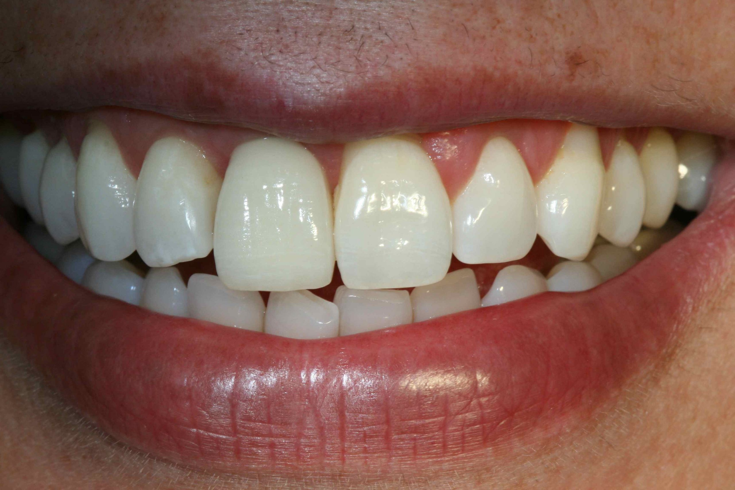 Image of a patient smiling