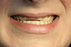 woman smiling