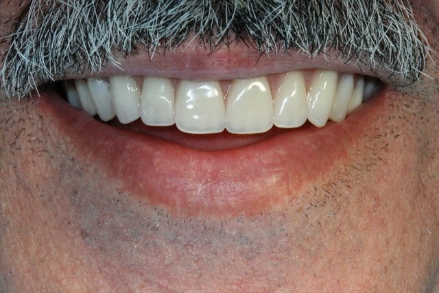 smiling man with moustache