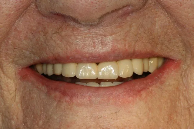 smiling man with yellow teeth