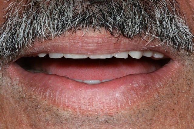 mouth partially opened with moustache