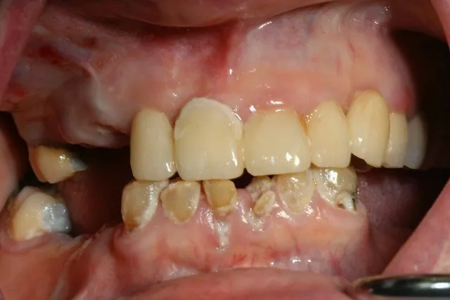 up close image of crooked teeth
