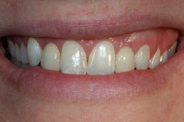smiling woman before crown